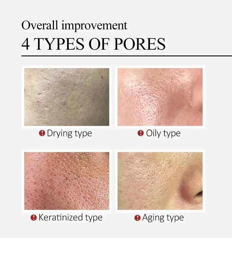 Creme para diminuir poros com ácido salicílico